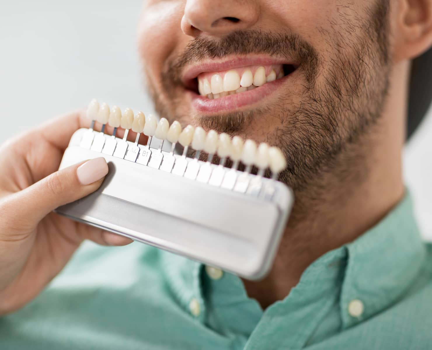 Dentisterie esthétique
