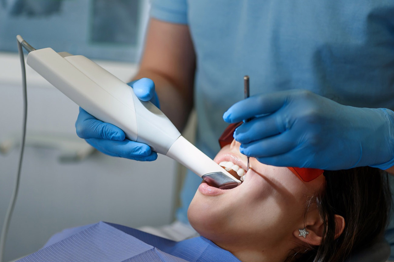 Scanner intra-oral pour empreinte digitale